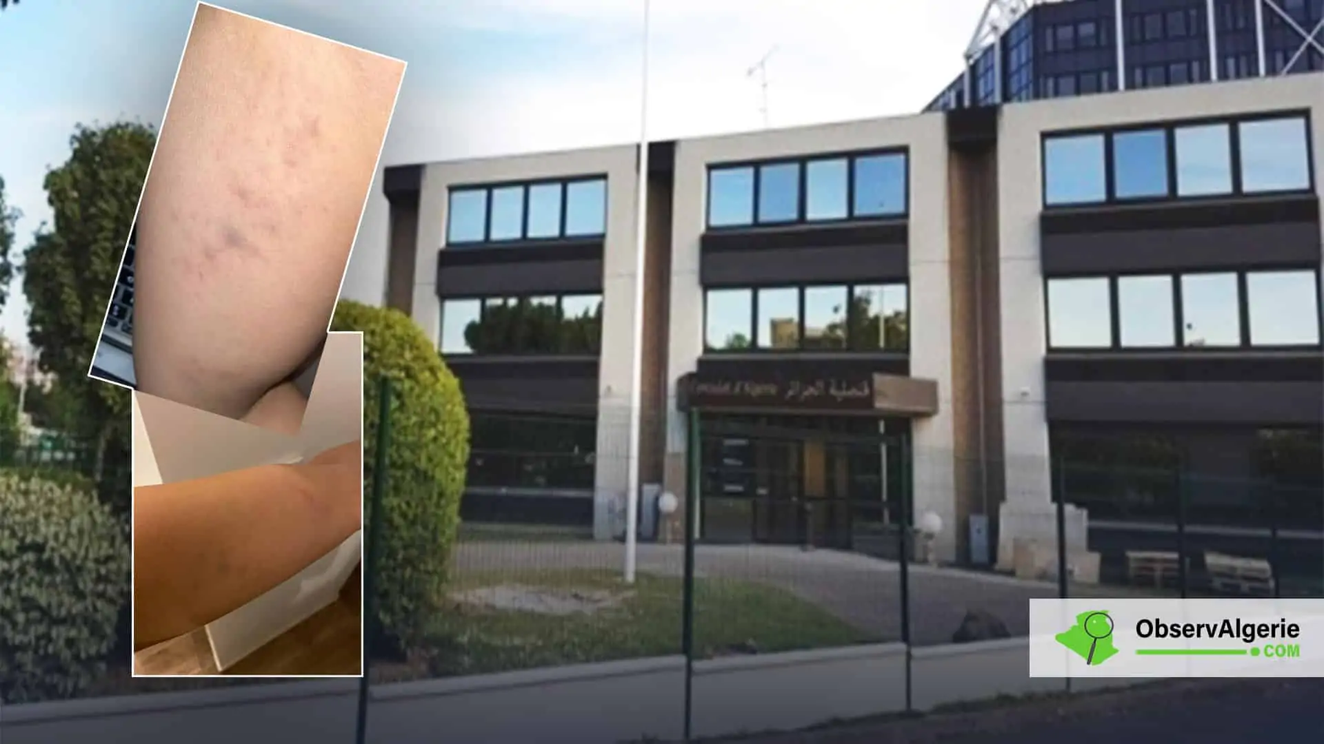 Photo : Une étudiante tabassée au Consulat d'Algérie à Créteil