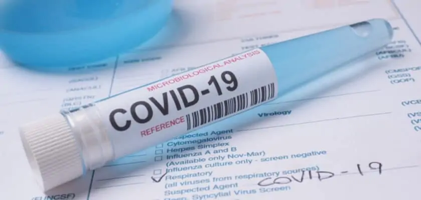 Covid-19 coronavirus lab test with label on test-tube